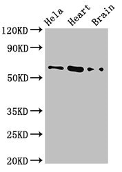 BAIAP2 / IRSP53 Antibody - Western Blot Positive WB detected in: Hela whole cell lysate, Mouse heart tissue, Mouse brain tissue All lanes: BAIAP2 antibody at 3.2µg/ml Secondary Goat polyclonal to rabbit IgG at 1/50000 dilution Predicted band size: 61, 60, 57, 58 kDa Observed band size: 61 kDa