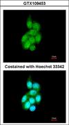 BAIAP2L1 Antibody - Immunofluorescence of methanol-fixed A431 using BAIAP2L1 antibody at 1:200 dilution.