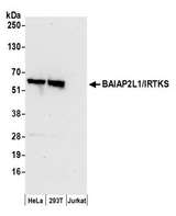 BAIAP2L1 Antibody - Detection of human BAIAP2L1/IRTKS by western blot. Samples: Whole cell lysate (50 µg) from HeLa, HEK293T, and Jurkat cells prepared using NETN lysis buffer. Antibody: Affinity purified rabbit anti-BAIAP2L1/IRTKS antibody used for WB at 0.1 µg/ml. Detection: Chemiluminescence with an exposure time of 30 seconds.