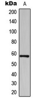 BAIAP2L1 Antibody - Western blot analysis of BAIAP2L1 expression in HeLa (A) whole cell lysates.