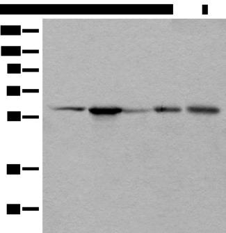 BAIAP2L1 Antibody - Western blot analysis of HEPG2 Hela A172 A549 and A431 cell lysates  using BAIAP2L1 Polyclonal Antibody at dilution of 1:800