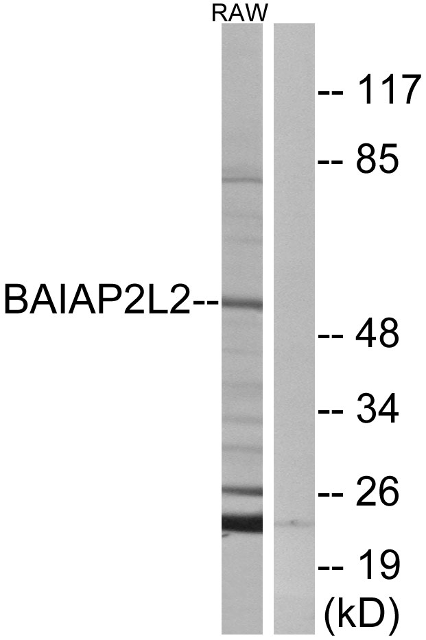 BAIAP2L2 Antibody - Western blot analysis of lysates from RAW264.7 cells, using BAIAP2L2 Antibody. The lane on the right is blocked with the synthesized peptide.