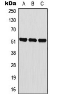 BAIAP2L2 Antibody - Western blot analysis of BAIAP2L2 expression in HeLa (A); HL60 (B); NIH3T3 (C) whole cell lysates.