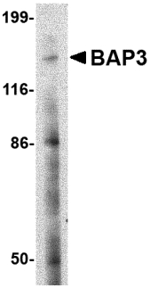 BAIAP3 Antibody - Western blot of BAP3 in SK-N-SH cell lysate with BAP3 antibody at 2 ug/ml.