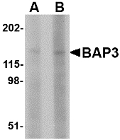 BAIAP3 Antibody - Western blot of BAP3 in SK-N-SH cell lysate with BAP3 antibody at (A) 1 and (B) 2 ug/ml.
