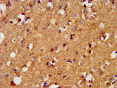 BAIAP3 Antibody - Immunohistochemistry image at a dilution of 1:400 and staining in paraffin-embedded human brain tissue performed on a Leica BondTM system. After dewaxing and hydration, antigen retrieval was mediated by high pressure in a citrate buffer (pH 6.0) . Section was blocked with 10% normal goat serum 30min at RT. Then primary antibody (1% BSA) was incubated at 4 °C overnight. The primary is detected by a biotinylated secondary antibody and visualized using an HRP conjugated SP system.