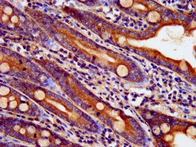 BAIAP3 Antibody - Immunohistochemistry image at a dilution of 1:400 and staining in paraffin-embedded human small intestine tissue performed on a Leica BondTM system. After dewaxing and hydration, antigen retrieval was mediated by high pressure in a citrate buffer (pH 6.0) . Section was blocked with 10% normal goat serum 30min at RT. Then primary antibody (1% BSA) was incubated at 4 °C overnight. The primary is detected by a biotinylated secondary antibody and visualized using an HRP conjugated SP system.