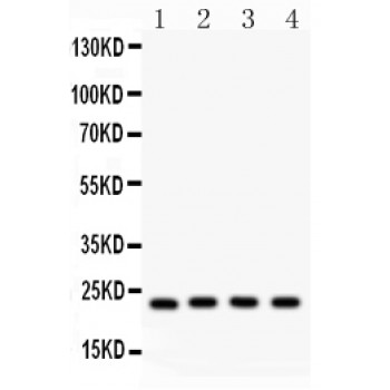 BAK1 / BAK Antibody - BAK antibody Western blot. All lanes: Anti BAK at 0.5 ug/ml. Lane 1: Rat Skeletal Muscle Tissue Lysate at 50 ug. Lane 2: Mouse Cardiac Muscle Tissue Lysate at 50 ug. Lane 3: MCF-7 Whole Cell Lysate at 40 ug. Lane 4: HELA Whole Cell Lysate at 40 ug. Predicted band size: 23 kD. Observed band size: 23 kD.