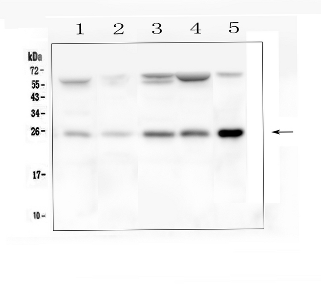 BAK1 / BAK Antibody - Western blot analysis of BAK using anti-BAK antibody. Electrophoresis was performed on a 5-20% SDS-PAGE gel at 70V (Stacking gel) / 90V (Resolving gel) for 2-3 hours. The sample well of each lane was loaded with 50ug of sample under reducing conditions. Lane 1: rat skeletal muscle tissue lysates, Lane 2: rat lung tissue lysates, Lane 3: mouse heart tissue lysates, Lane 4: mouse skeletal muscle tissue lysates, Lane 5: mouse lung tissue lysates. After Electrophoresis, proteins were transferred to a Nitrocellulose membrane at 150mA for 50-90 minutes. Blocked the membrane with 5% Non-fat Milk/ TBS for 1.5 hour at RT. The membrane was incubated with rabbit anti-BAK antigen affinity purified polyclonal antibody at 0.5 µg/mL overnight at 4°C, then washed with TBS-0.1% Tween 3 times with 5 minutes each and probed with a goat anti-rabbit IgG-HRP secondary antibody at a dilution of 1:10000 for 1.5 hour at RT. The signal is developed using an Enhanced Chemiluminescent detection (ECL) kit with Tanon 5200 system. A specific band was detected for BAK at approximately 25KD. The expected band size for BAK is at 23KD.