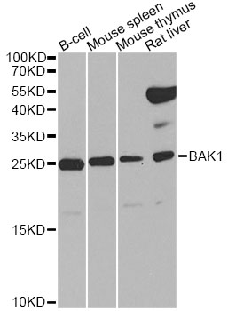 BAK1 / BAK Antibody - Western blot analysis of extracts of various cell lines, using BAK1 antibody at 1:1000 dilution. The secondary antibody used was an HRP Goat Anti-Rabbit IgG (H+L) at 1:10000 dilution. Lysates were loaded 25ug per lane and 3% nonfat dry milk in TBST was used for blocking. An ECL Kit was used for detection and the exposure time was 30s.