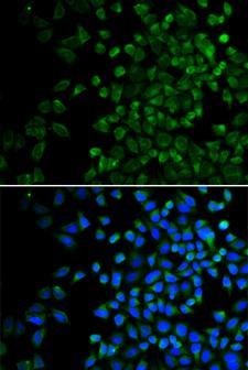 BAK1 / BAK Antibody - Immunofluorescence analysis of HeLa cells using BAK1 antibody. Blue: DAPI for nuclear staining.