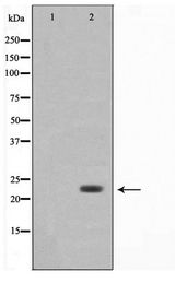 BAK1 / BAK Antibody - Western blot of 293 cell lysate using Bak Antibody
