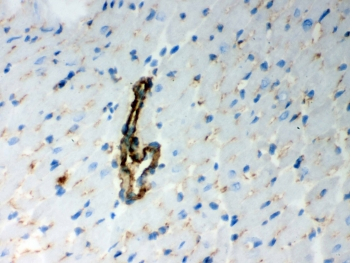 BAK1 / BAK Antibody - ICC testing of FFPE human A549 cells with BAK antibody. HIER: Boil the paraffin sections in pH 6, 10mM citrate buffer for 20 minutes and allow to cool prior to staining.