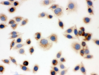 BAK1 / BAK Antibody - ICC testing of FFPE human SMMC-7721 cells with BAK antibody. HIER: Boil the paraffin sections in pH 6, 10mM citrate buffer for 20 minutes and allow to cool prior to staining.
