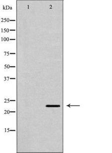 BAK1 / BAK Antibody - Western blot analysis of extracts of MCF-7 using BAK1 antibody. The lane on the left is treated with the antigen-specific peptide.