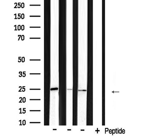BAK1 / BAK Antibody - Western blot analysis of extracts of various samples using bak1 antibody.