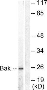 BAK1 / BAK Antibody - Western blot analysis of extracts from 293 cells, using Bak antibody.