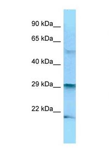 BAK1 / BAK Antibody - BAK1 / BAK antibody Western blot of Fetal Heart lysate. Antibody concentration 1 ug/ml.  This image was taken for the unconjugated form of this product. Other forms have not been tested.