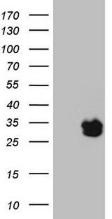 BAMBI Antibody - HEK293T cells were transfected with the pCMV6-ENTRY control. (Left lane) or pCMV6-ENTRY BAMBI. (Right lane) cDNA for 48 hrs and lysed. Equivalent amounts of cell lysates. (5 ug per lane) were separated by SDS-PAGE and immunoblotted with anti-BAMBI. (1:2000)