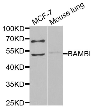 BAMBI Antibody - Western blot analysis of extracts of various cells.