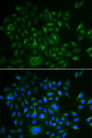 BAMBI Antibody - Immunofluorescence analysis of HeLa cells.