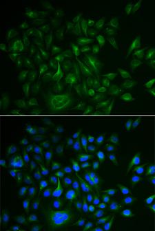 BAMBI Antibody - Immunofluorescence analysis of HeLa cells.