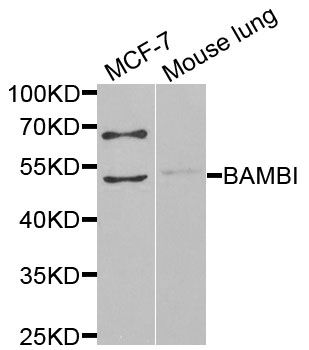 BAMBI Antibody - Western blot analysis of extracts of various cell lines, using BAMBI antibody at 1:1000 dilution. The secondary antibody used was an HRP Goat Anti-Rabbit IgG (H+L) at 1:10000 dilution. Lysates were loaded 25ug per lane and 3% nonfat dry milk in TBST was used for blocking. An ECL Kit was used for detection and the exposure time was 10s.