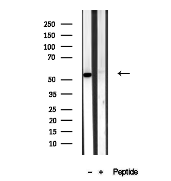 BAMBI Antibody - Western blot analysis of extracts of rat Kidney tissue using BAMBI antibody.