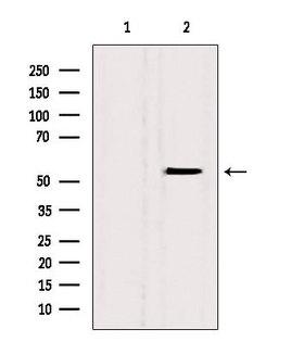 BAMBI Antibody - Western blot analysis of extracts of HeLa cells using BAMBI antibody. Lane 1 was treated with the blocking peptide.