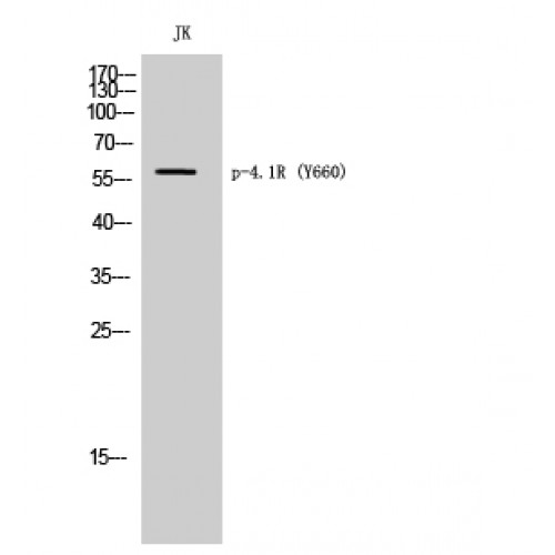 Band 4.1 / EPB41 Antibody - Western blot of Phospho-4.1R (Y660) antibody