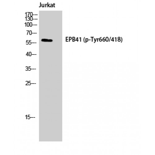 Band 4.1 / EPB41 Antibody - Western blot of Phospho-4.1R (Y660) antibody