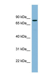 Band 4.1 / EPB41 Antibody - EPB41 antibody Western blot of Fetal Spleen lysate. This image was taken for the unconjugated form of this product. Other forms have not been tested.