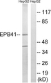 Band 4.1 / EPB41 Antibody - Western blot analysis of lysates from HepG2 cells treated with PMA 125ng/ml 30', using EPB41 Antibody. The lane on the right is blocked with the synthesized peptide.