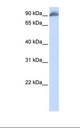 Band 4.1 / EPB41 Antibody - Jurkat cell lysate. Antibody concentration: 1.0 ug/ml. Gel concentration: 12%.  This image was taken for the unconjugated form of this product. Other forms have not been tested.