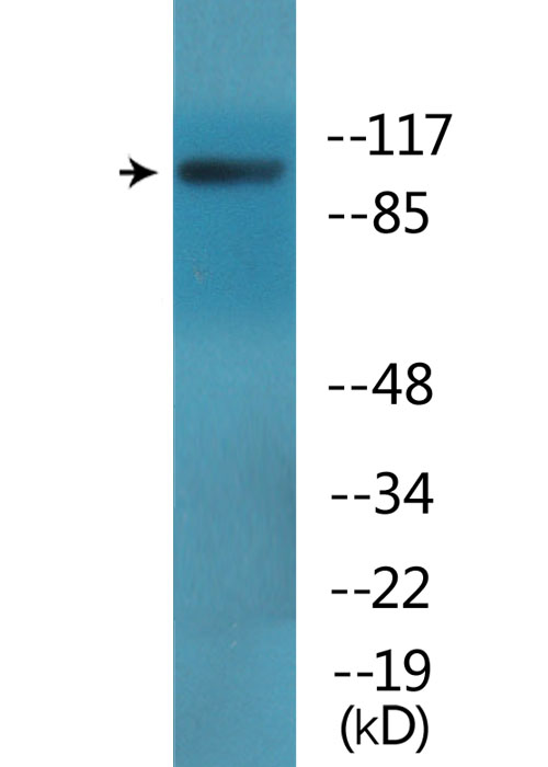 Band 4.1 / EPB41 Antibody - Western blot analysis of lysates from HepG2 cells treated with PMA 125ng/ml 30', using EPB41 (Phospho-Tyr660/418) Antibody.