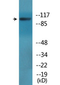 Band 4.1 / EPB41 Antibody - Western blot analysis of lysates from HepG2 cells treated with PMA 125ng/ml 30', using EPB41 (Phospho-Tyr660/418) Antibody.
