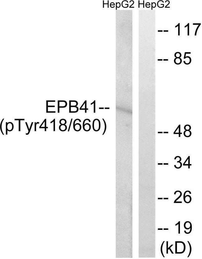 Band 4.1 / EPB41 Antibody - Western blot analysis of extracts from HepG2 cells, treated with PMA (125ng/ml, 30mins), using EPB41 (Phospho-Tyr660/418) antibody.