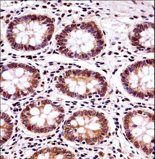 BANF1 / BAF / BCRP1 Antibody - BANF1 Antibody immunohistochemistry of formalin-fixed and paraffin-embedded human colon tissue followed by peroxidase-conjugated secondary antibody and DAB staining.