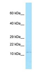 BANF1 / BAF / BCRP1 Antibody - BANF1 / BAF / BCRP1 antibody Western Blot of MCF7.  This image was taken for the unconjugated form of this product. Other forms have not been tested.