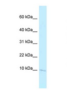 BANF2 Antibody - Banf2 antibody Western blot of Small Intestine lysate. Antibody concentration 1 ug/ml.  This image was taken for the unconjugated form of this product. Other forms have not been tested.