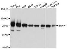 BANK1 / BANK Antibody - Western blot analysis of extracts of various cell lines, using BANK1 antibody at 1:1000 dilution. The secondary antibody used was an HRP Goat Anti-Rabbit IgG (H+L) at 1:10000 dilution. Lysates were loaded 25ug per lane and 3% nonfat dry milk in TBST was used for blocking. An ECL Kit was used for detection and the exposure time was 3s.