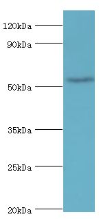 BANP Antibody - Western blot. All lanes: Protein BANP antibody at 6 ug/ml+HepG2 whole cell lysate. Secondary antibody: Goat polyclonal to rabbit at 1:10000 dilution. Predicted band size: 56 kDa. Observed band size: 56 kDa Immunohistochemistry.