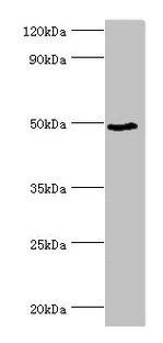 BANP Antibody - Western blot All lanes: BANP antibody at 6µg/ml + HepG2 whole cell lysate Secondary Goat polyclonal to rabbit IgG at 1/10000 dilution Predicted band size: 57, 52, 49, 54, 55, 51, 56 kDa Observed band size: 49 kDa