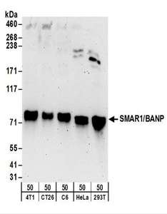 BANP Antibody - Detection of Human, Mouse and Rat SMAR1/BANP by Western Blot. Samples: Whole cell lysate (50 ug) from mouse 4T1, mouse CT26.WT, rat C6, HeLa, and 293T cells. Antibodies: Affinity purified rabbit anti-SMAR1/BANP antibody used for WB at 0.1 ug/ml. Detection: Chemiluminescence with an exposure time of 3 minutes.