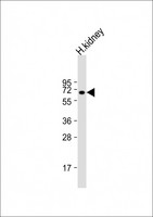 BANP Antibody - Anti-BANP Antibody (N-Term) at 1:2000 dilution + human kidney lysate Lysates/proteins at 20 ug per lane. Secondary Goat Anti-Rabbit IgG, (H+L), Peroxidase conjugated at 1:10000 dilution. Predicted band size: 56 kDa. Blocking/Dilution buffer: 5% NFDM/TBST.