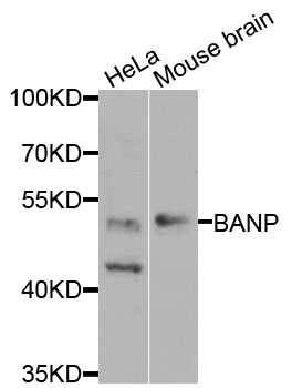 BANP Antibody - Western blot analysis of extracts of various cells.