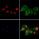BANP Antibody - Staining HeLa cells by IF/ICC. The samples were fixed with PFA and permeabilized in 0.1% Triton X-100, then blocked in 10% serum for 45 min at 25°C. Samples were then incubated with primary Ab(1:200) and mouse anti-beta tubulin Ab(1:200) for 1 hour at 37°C. An AlexaFluor594 conjugated goat anti-rabbit IgG(H+L) Ab(1:200 Red) and an AlexaFluor488 conjugated goat anti-mouse IgG(H+L) Ab(1:600 Green) were used as the secondary antibod