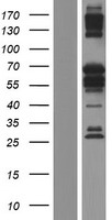 BANP Protein - Western validation with an anti-DDK antibody * L: Control HEK293 lysate R: Over-expression lysate