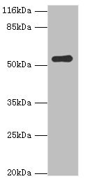 BAP / SIL1 Antibody - Western blot All lanes: SIL1 antibody at 2µg/ml + Mouse kidney tissue Secondary Goat polyclonal to rabbit IgG at 1/10000 dilution Predicted band size: 52 kDa Observed band size: 52 kDa