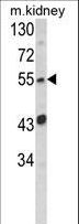 BAP / SIL1 Antibody - Western blot of SIL1 Antibody in mouse kidney tissue lysates (35 ug/lane). SIL1 (arrow) was detected using the purified antibody.